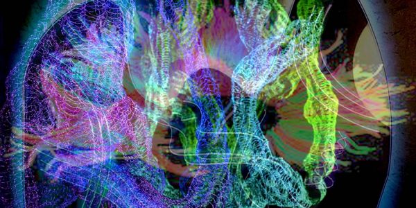 Kunst-Installation im Rieckhof: Well Wired Team zeigt „White-Matter-Bypass“